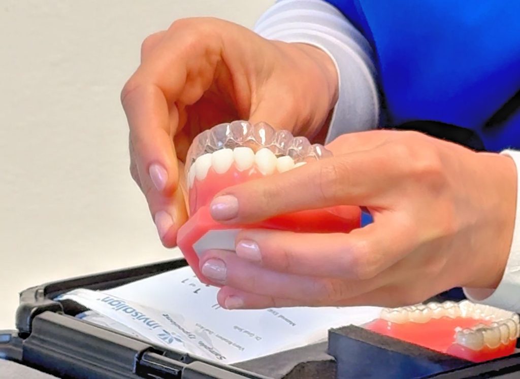 Ortodonzia trasparente 5 Apparecchio trasparente a Pisa - Come funzionano le mascherine per i denti?