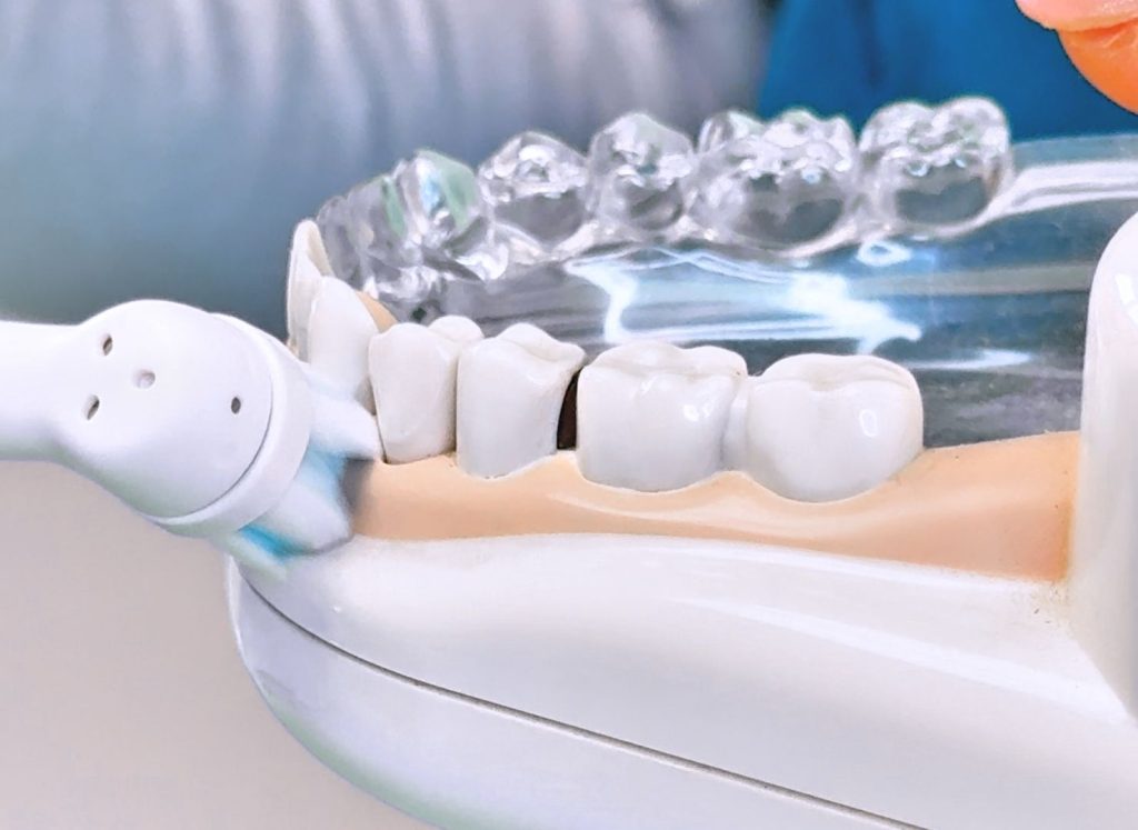 Studio Odontoiatrico Bandettini - È dolorosa la pulizia dei denti?