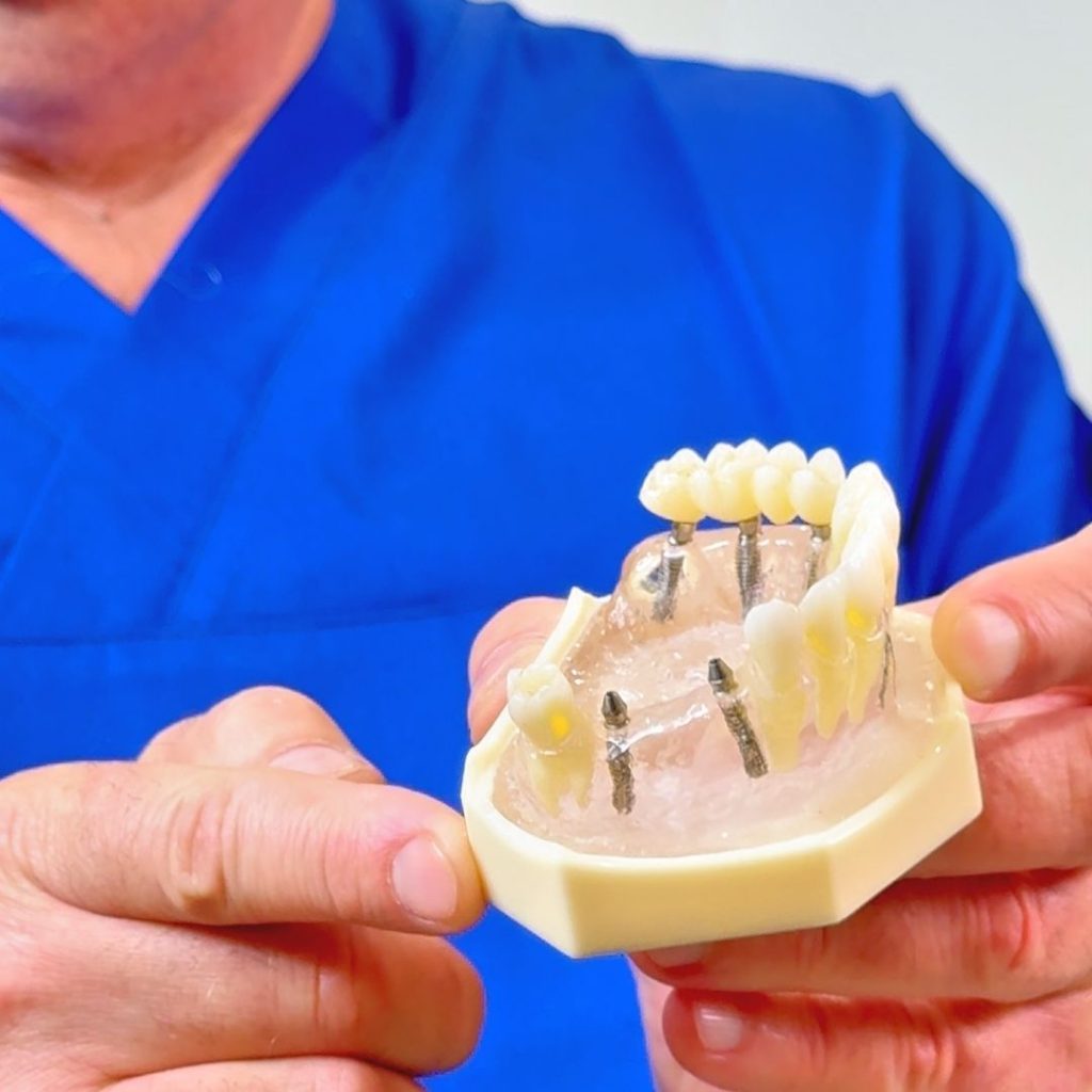 Implantologia 1 IMPLANTOLOGIA - impianti dentali a Pisa - impianto dentale a Pisa