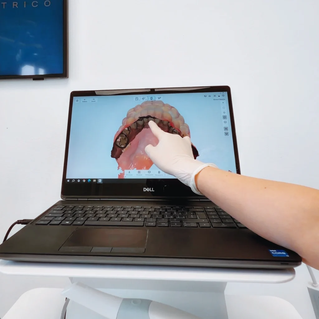 Ortodonzia 1 ORTODONZIA FISSA, INTERCETTIVA E MOBILE - apparecchio dentale a Pisa