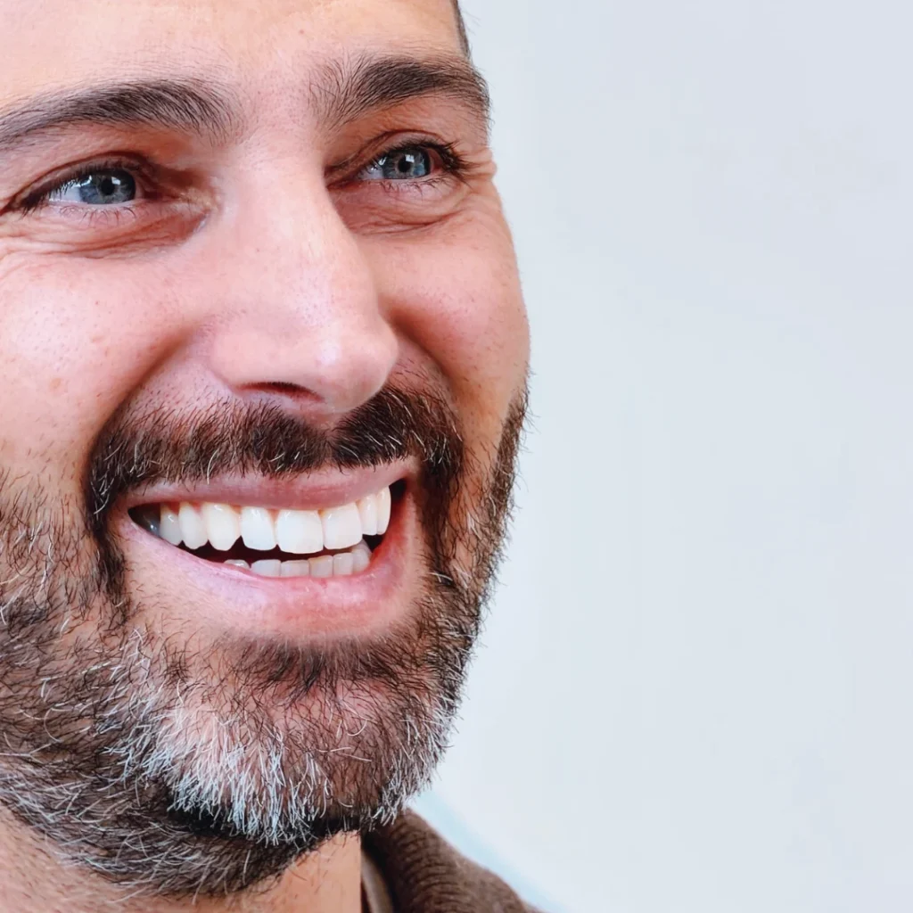 SBIANCAMENTO - sbiancamento dentale a Pisa - Come funziona lo sbiancamento dentale dal dentista