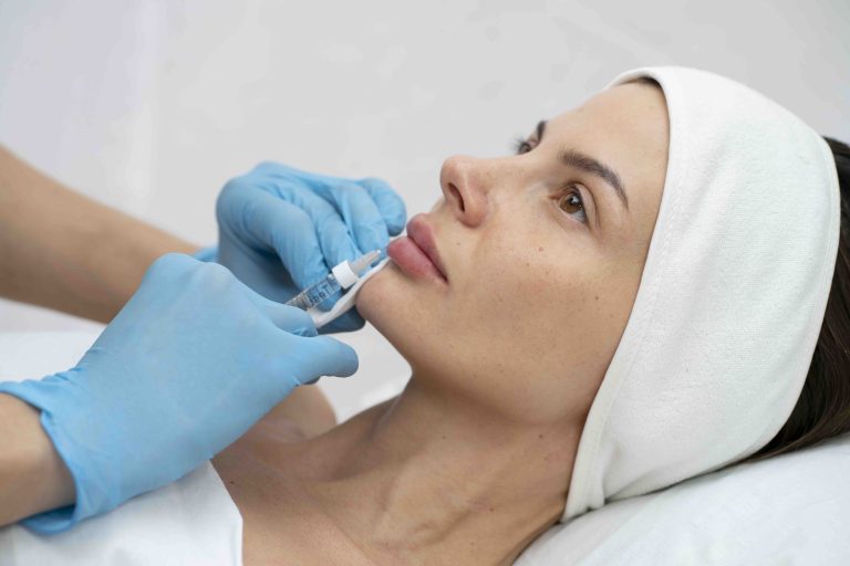 Tecniche di iniezione per il filler labbra