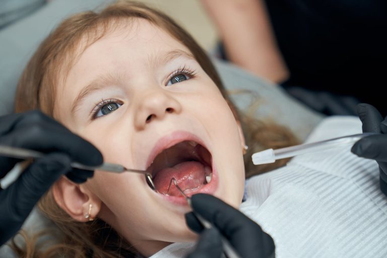 Blog 3 Quando cadono i denti da latte?